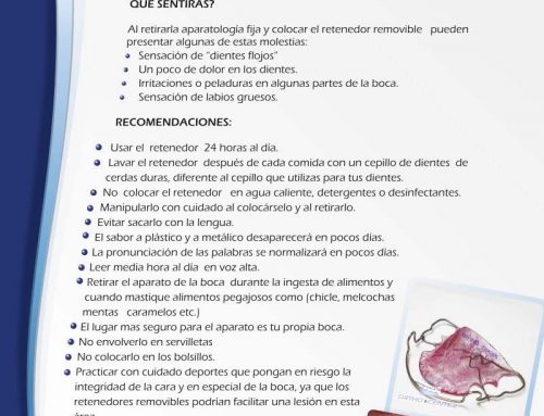 Recomendaciones para uso de retenedor removible